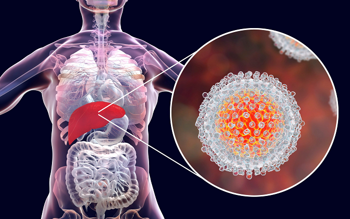 Hepatitis C puede ser curable con diagnóstico oportuno y tratamiento adecuado￼