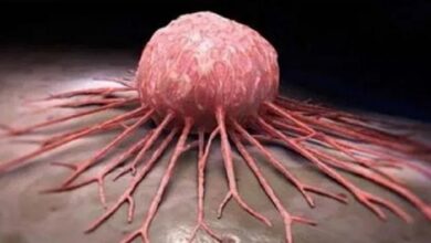 Cáncer, de las amenazas más graves de la salud global para la OMS