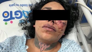 Paola Suárez, integrante de Las perdidas, ingresó al hospital por golpiza que le dio su novio