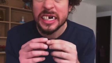 Se quita dos dientes Luisito Comunica como estrategia de publicidad para Netflix