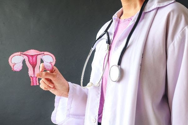 Una de cada 78 mujeres presentará cáncer de ovario y, de estas, el 70% recibirán el diagnóstico en una etapa avanzada